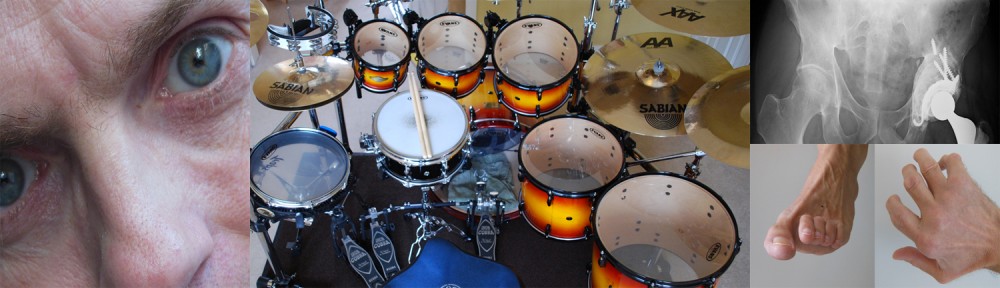 Arthritic Drummer